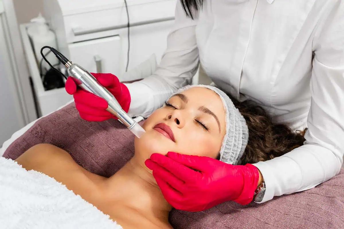 Microneedling Yuma Wellness And Aesthetics AZ